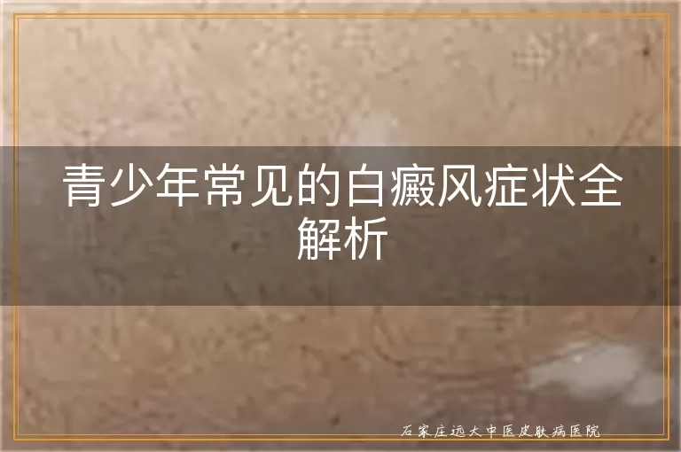 青少年常见的白癜风症状全解析