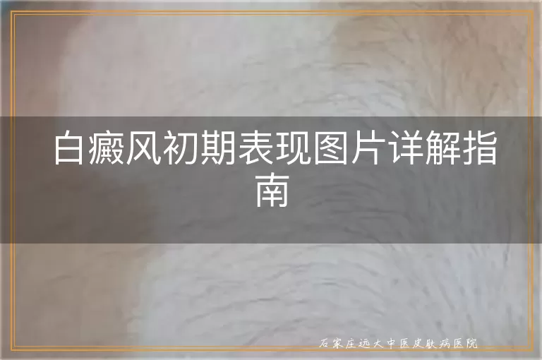 白癜风初期表现图片详解指南