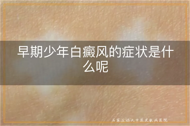 早期少年白癜风的症状是什么呢
