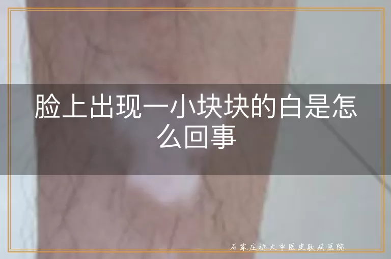 脸上出现一小块块的白是怎么回事