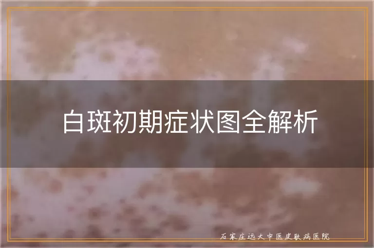白斑初期症状图全解析