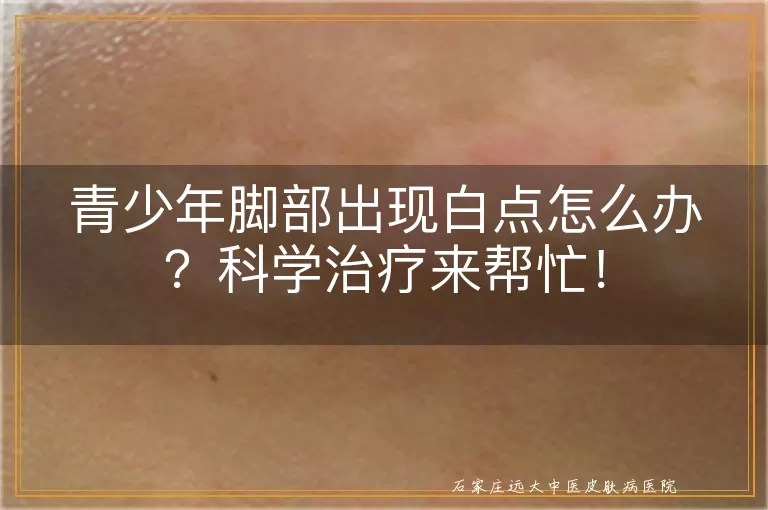 青少年脚部出现白点怎么办？科学治疗来帮忙！