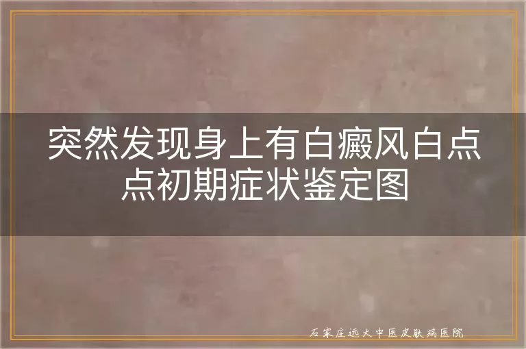 突然发现身上有白癜风白点点初期症状鉴定图