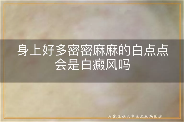 身上好多密密麻麻的白点点会是白癜风吗