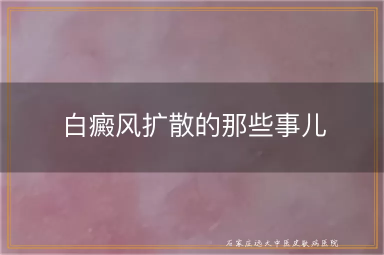 白癜风扩散的那些事儿