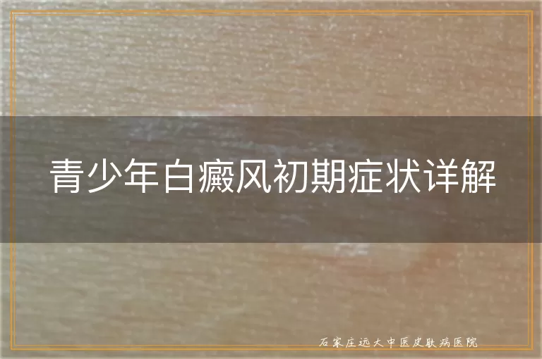 青少年白癜风初期症状详解