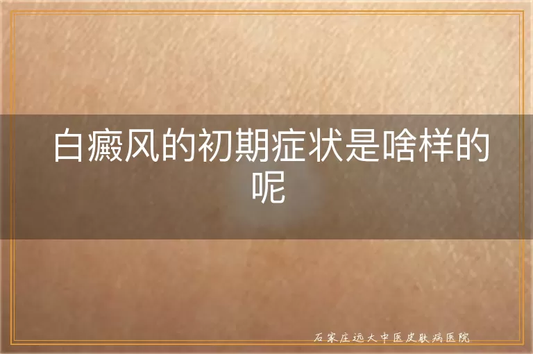 白癜风的初期症状是啥样的呢