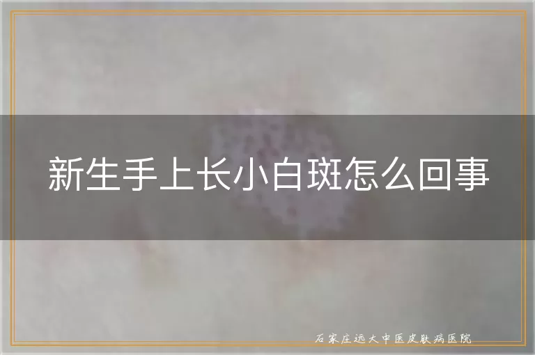 新生手上长小白斑怎么回事