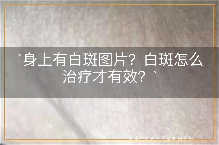 身上有白斑图片？白斑怎么治疗才有效？