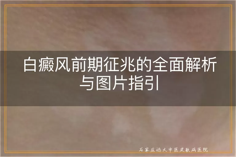 白癜风前期征兆的全面解析与图片指引