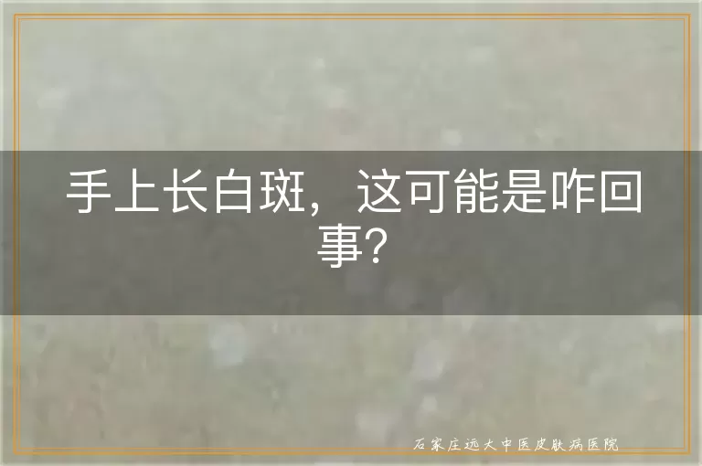 手上长白斑，这可能是咋回事？