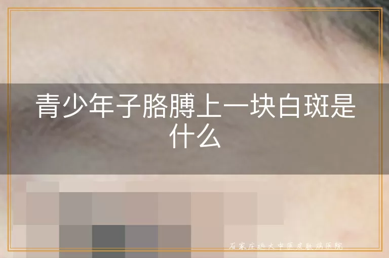 青少年子胳膊上一块白斑是什么