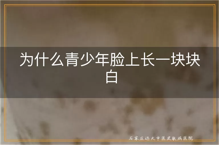 为什么青少年脸上长一块块白