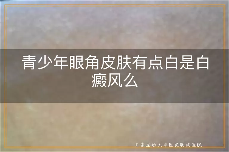 青少年眼角皮肤有点白是白癜风么