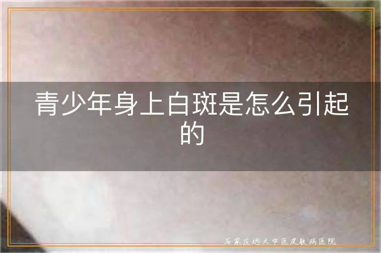 青少年身上白斑是怎么引起的