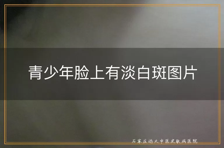 青少年脸上有淡白斑图片