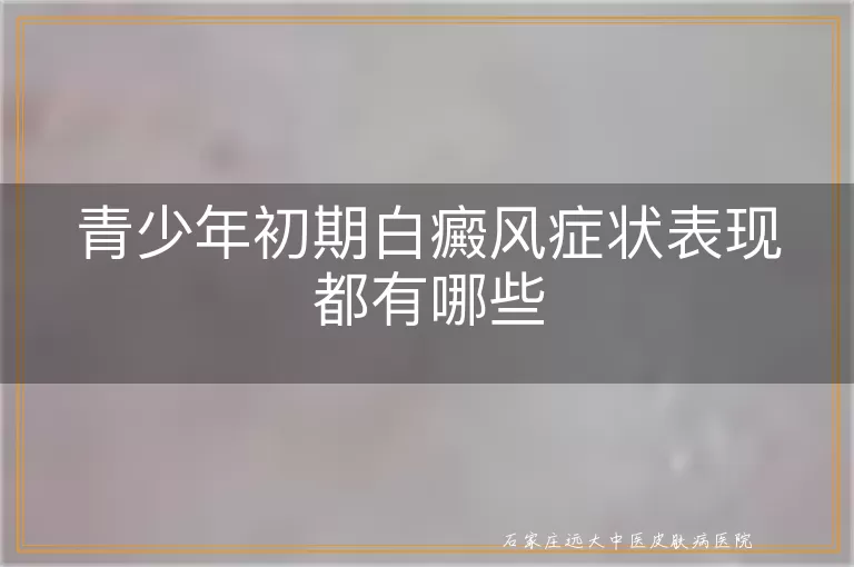 青少年初期白癜风症状表现都有哪些
