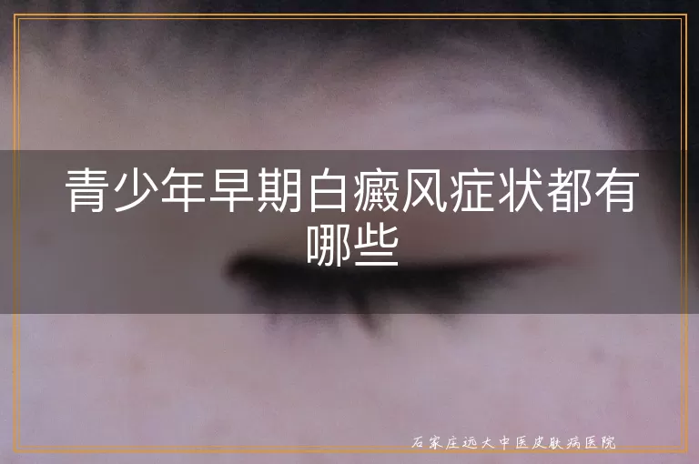 青少年早期白癜风症状都有哪些