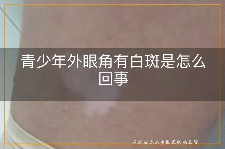 青少年外眼角有白斑是怎么回事