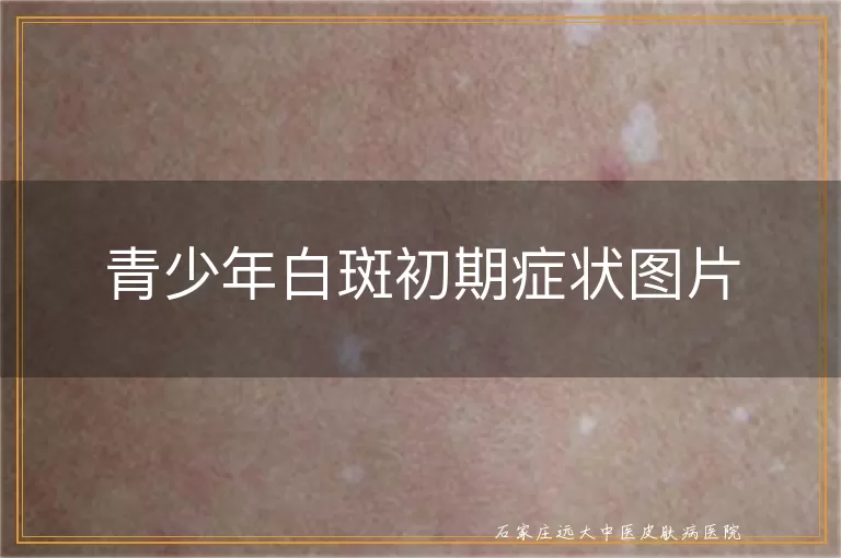 青少年白斑初期症状图片