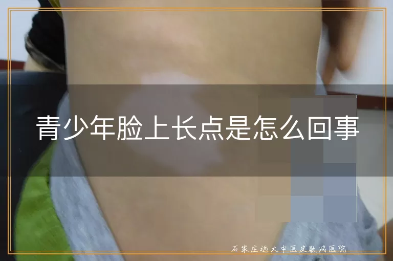 青少年脸上长点是怎么回事