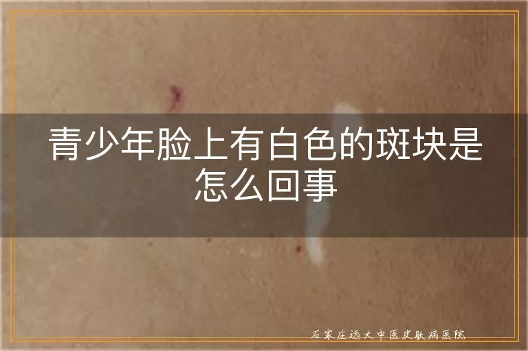 青少年脸上有白色的斑块是怎么回事