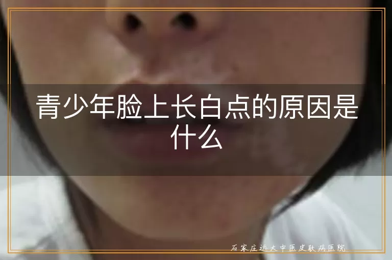 青少年脸上长白点的原因是什么
