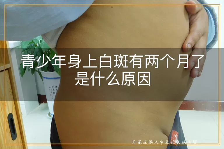 青少年身上白斑有两个月了是什么原因
