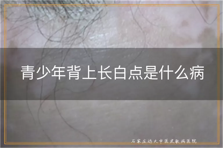 青少年背上长白点是什么病