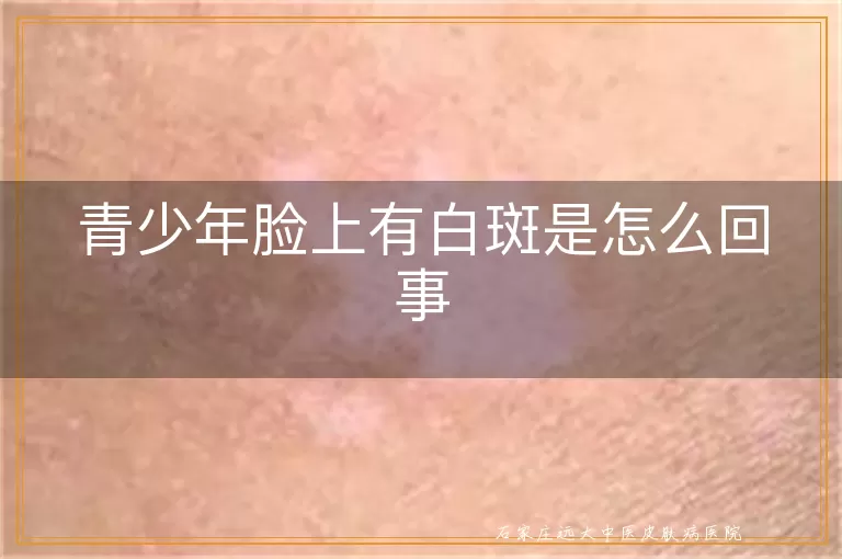 青少年脸上有白斑是怎么回事