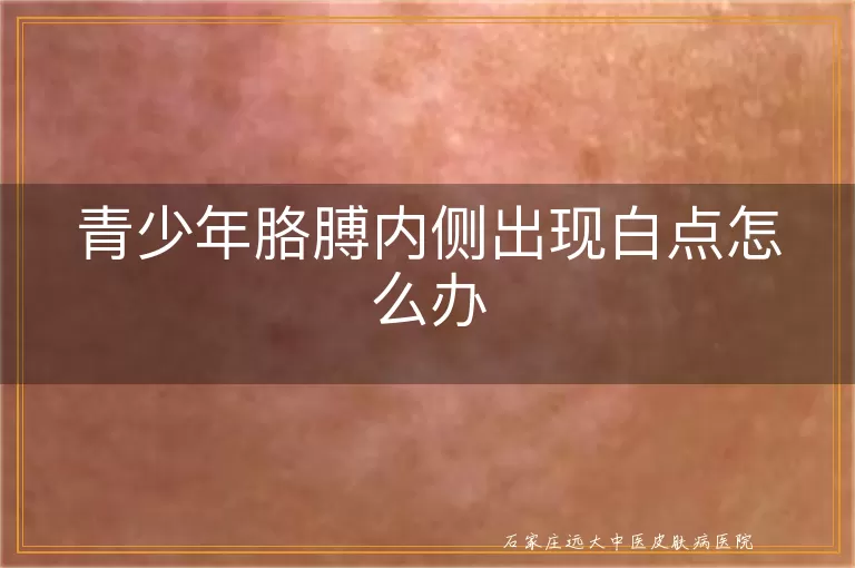 青少年胳膊内侧出现白点怎么办
