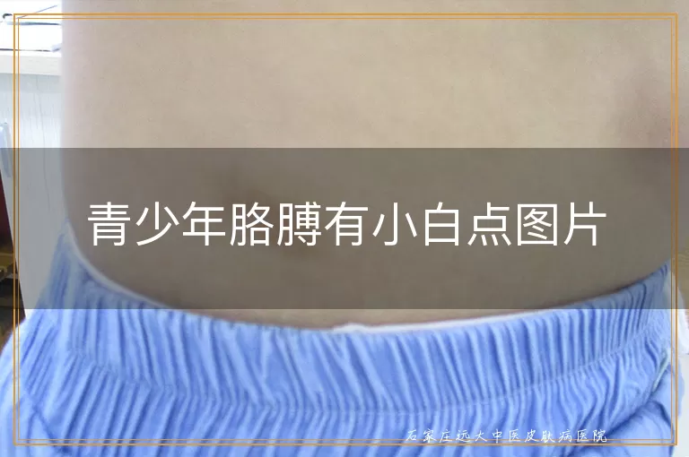 青少年胳膊有小白点图片