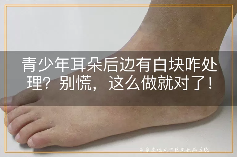 青少年耳朵后边有白块咋处理？别慌，这么做就对了！