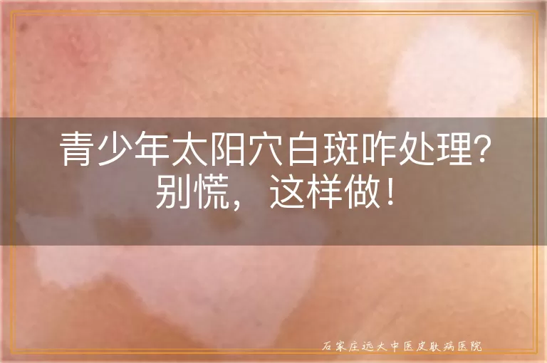 青少年太阳穴白斑咋处理？别慌，这样做！