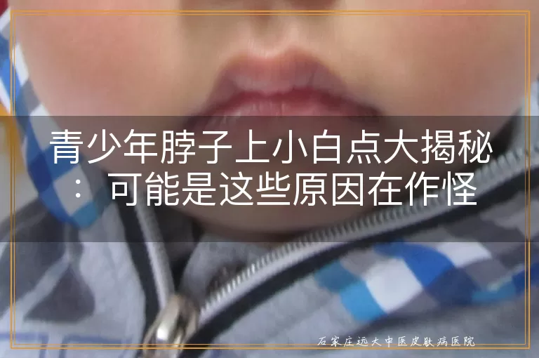 青少年脖子上小白点大揭秘：可能是这些原因在作怪