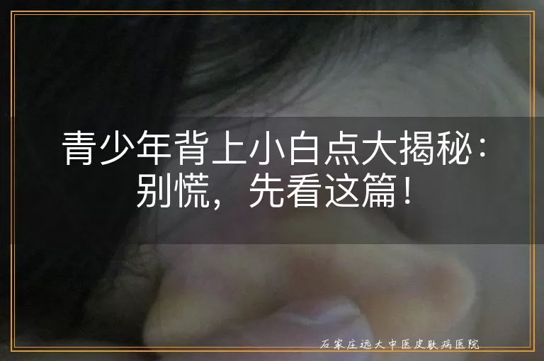 青少年背上小白点大揭秘：别慌，先看这篇！
