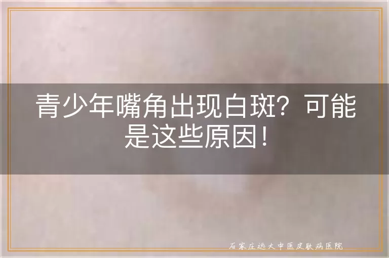 青少年嘴角出现白斑？可能是这些原因！