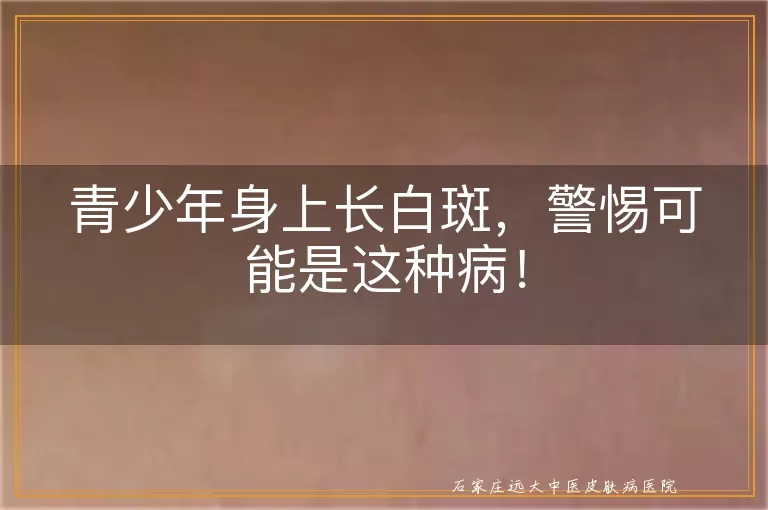 青少年身上长白斑，警惕可能是这种病！