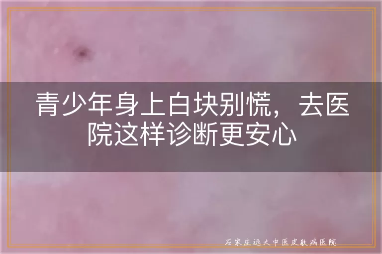 青少年身上白块别慌，去医院这样诊断更安心