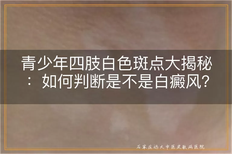 青少年四肢白色斑点大揭秘：如何判断是不是白癜风？