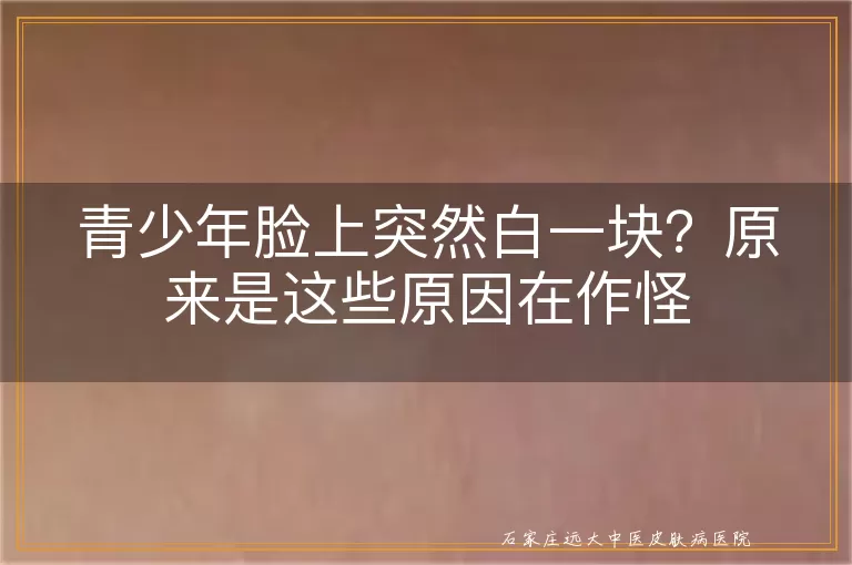 青少年脸上突然白一块？原来是这些原因在作怪