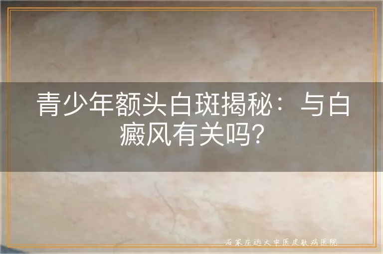 青少年额头白斑揭秘：与白癜风有关吗？