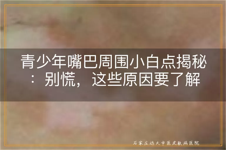 青少年嘴巴周围小白点揭秘：别慌，这些原因要了解