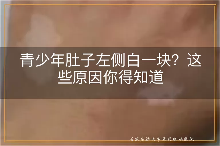 青少年肚子左侧白一块？这些原因你得知道