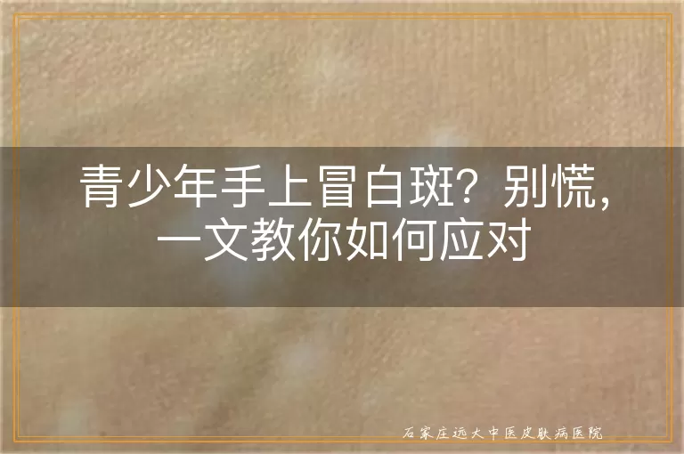 青少年手上冒白斑？别慌，一文教你如何应对