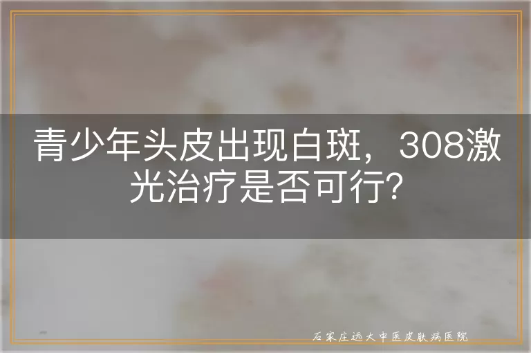 青少年头皮出现白斑，308激光治疗是否可行？