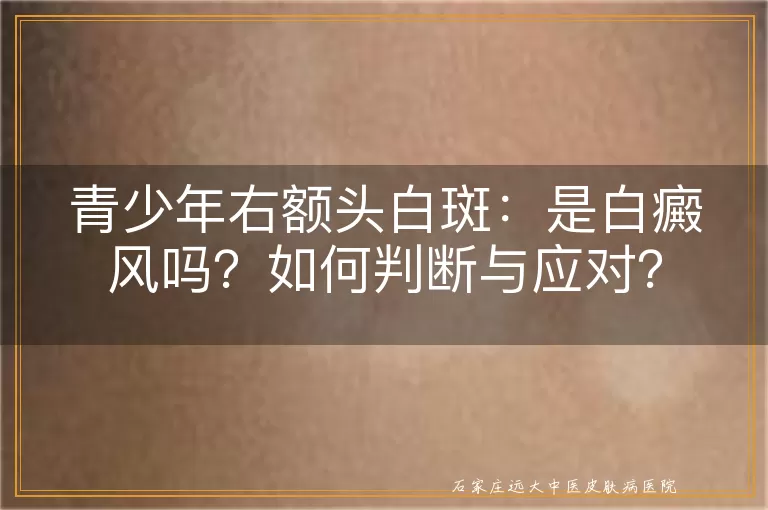 青少年右额头白斑：是白癜风吗？如何判断与应对？