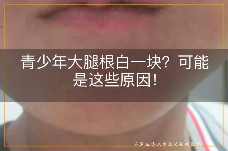 青少年大腿根白一块？可能是这些原因！