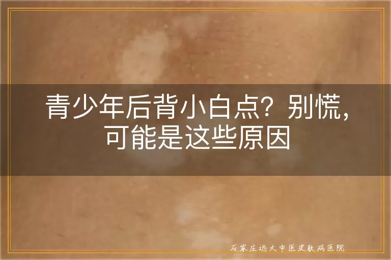 青少年后背小白点？别慌，可能是这些原因