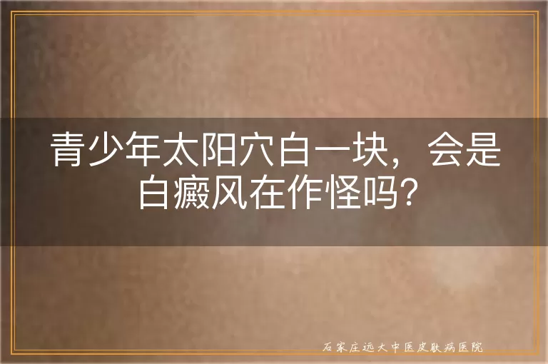 青少年太阳穴白一块，会是白癜风在作怪吗？